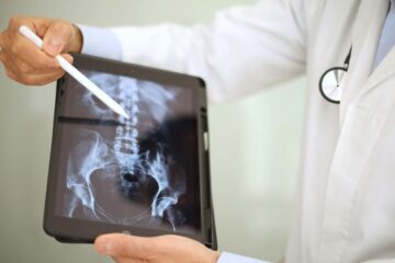 Distrofia muscular de Duchenne: tratamientos en Guatemala